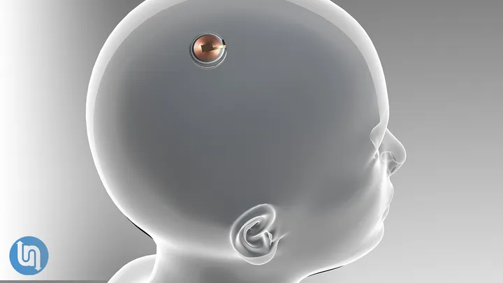 The Future of Neuralink - Where Will it Take Humanity?